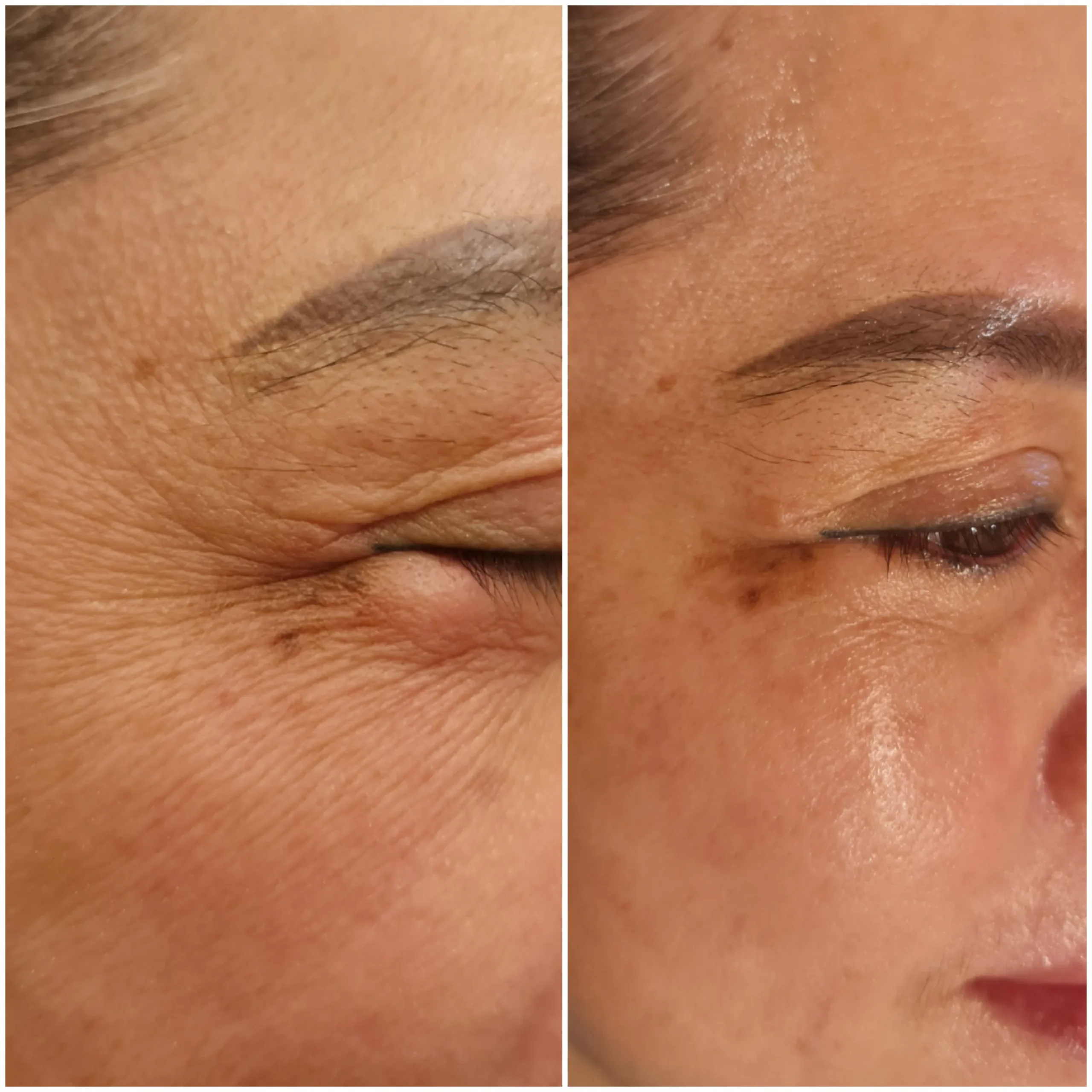 EYEVI EMS - Giải Pháp Toàn Diện Cho Đôi Mắt Trẻ Trung Không Tì Vết Siêu Hot 2025 - Ảnh 2