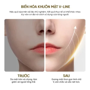 Alternative view of Máy Massager Thon Gọn Mặt VFace - Giải Pháp Làm Đẹp Công Nghệ Cao Tại Nhà 2025