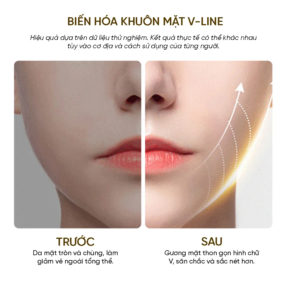 Máy Massager Thon Gọn Mặt VFace - Giải Pháp Làm Đẹp Công Nghệ Cao Tại Nhà 2025 - Ảnh 2