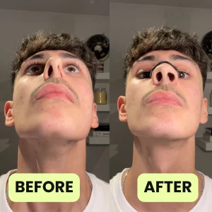 Alternative view of Kẹp Mũi Nam Châm Chống Ngáy Oxybreathing Nasal, Tăng Oxy, Cải Thiện Giấc Ngủ Tốt Nhất 2025