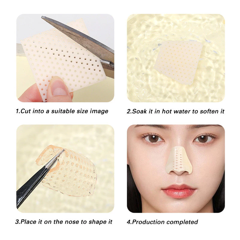 Nẹp Mũi Nhựa Nhiệt Dẻo - Giải Pháp Định Hình & Bảo Vệ Sống Mũi Hiệu Quả 2025 - Ảnh 9